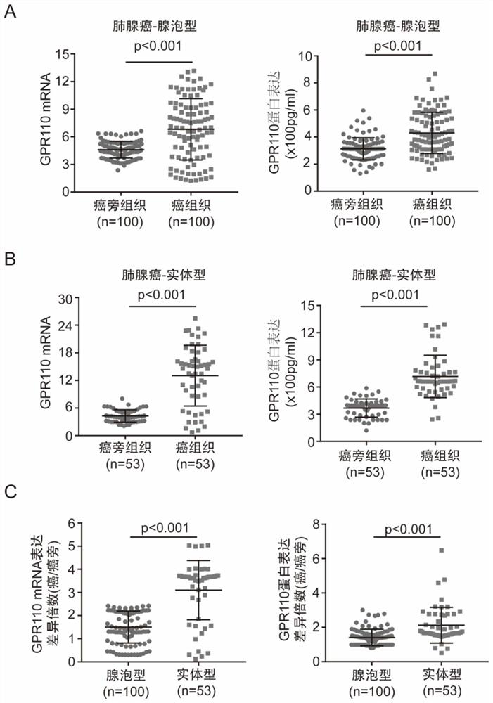 Application of GPR110, VEGFR and CD34 in identification of lung adenocarcinoma subtypes