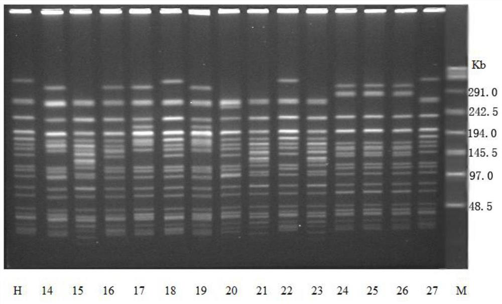 DNA extraction method in pulse field gel electrophoresis (PFGE) method parting of mycobacterium tuberculosis (M. tb)