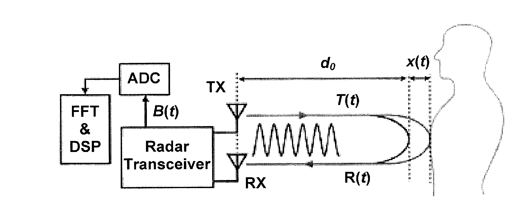 Method and apparatus for doppler radar signal recovery of target displacement