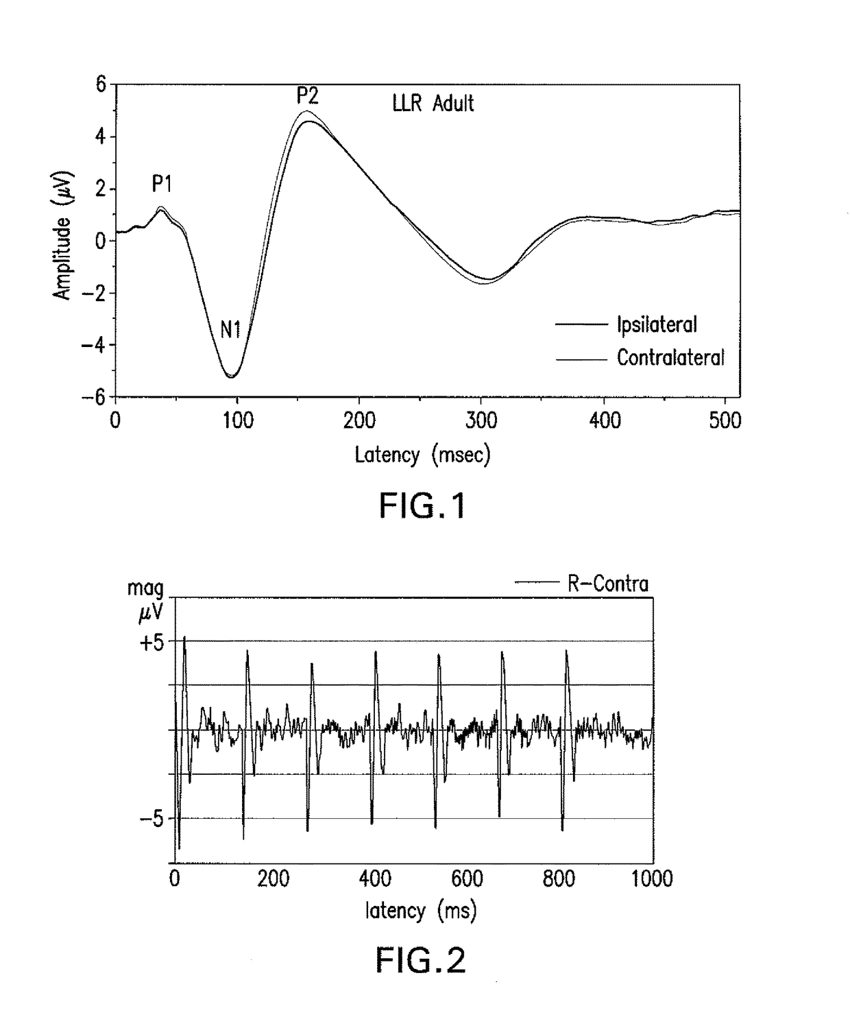 Steady state measurement and analysis approach to profiling auditory evoked potentials from short-latency to long latency