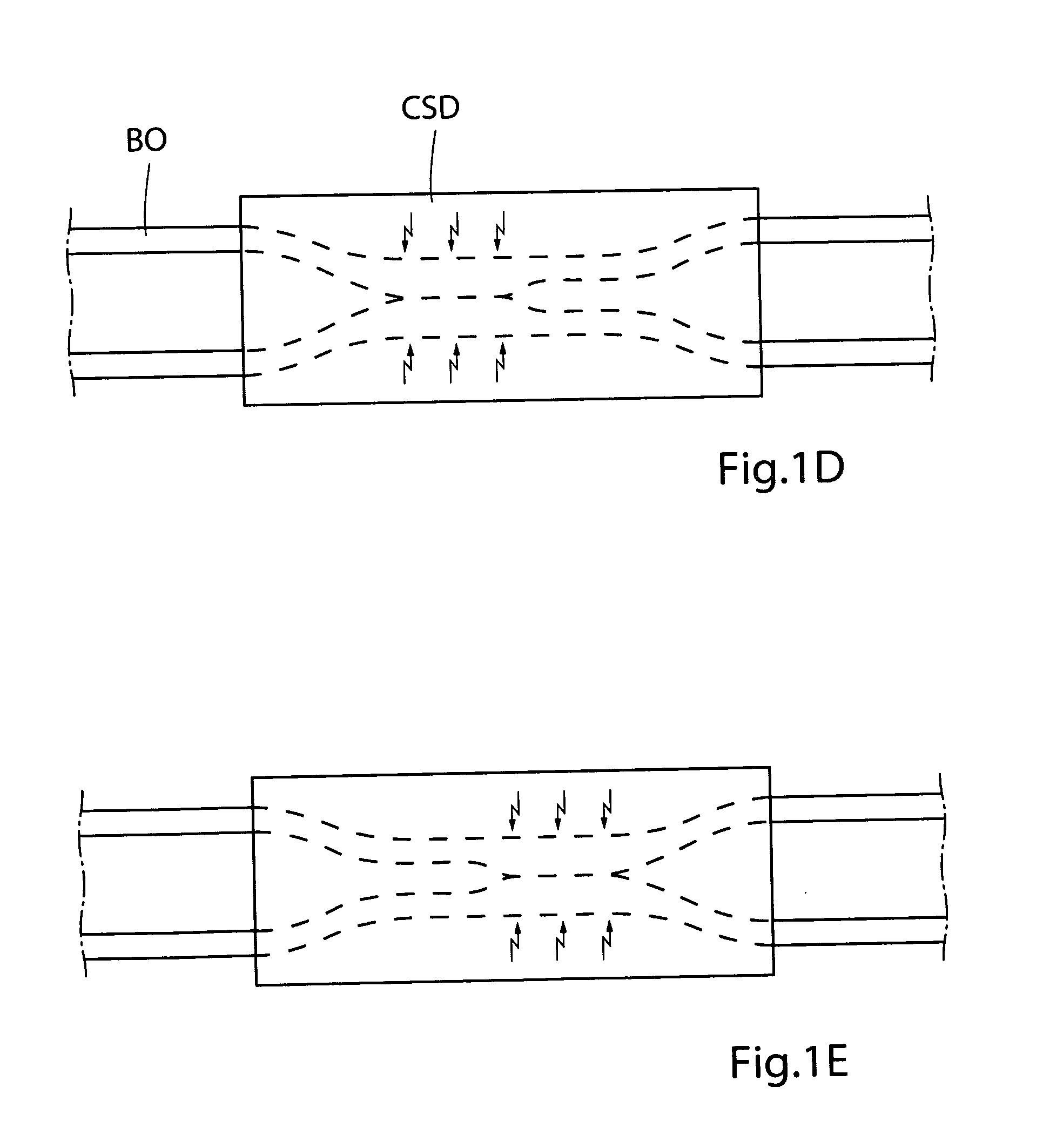 Method for controlling flow of intestinal contents in a patient's intestines