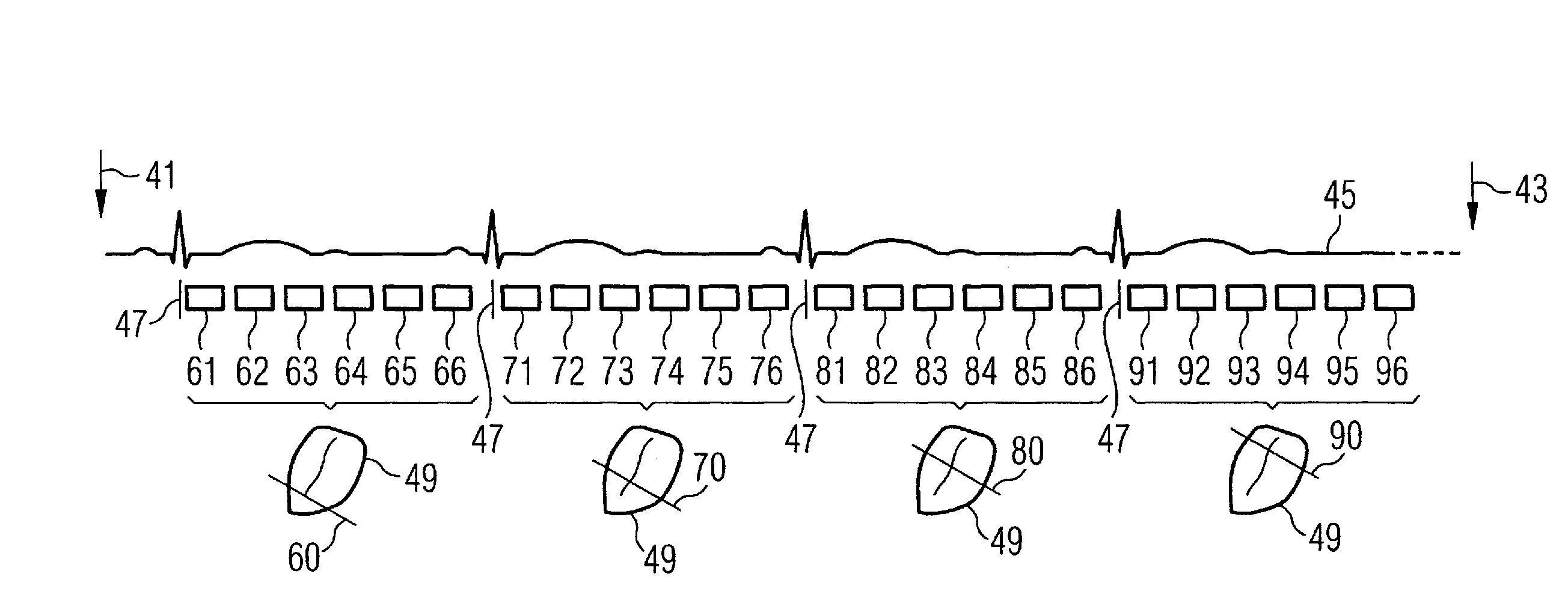 Magnetic resonance apparatus and method to acquire and display calibration images