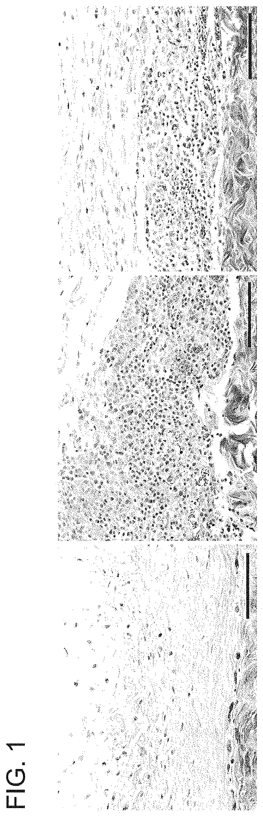 Methods for tissue passivation