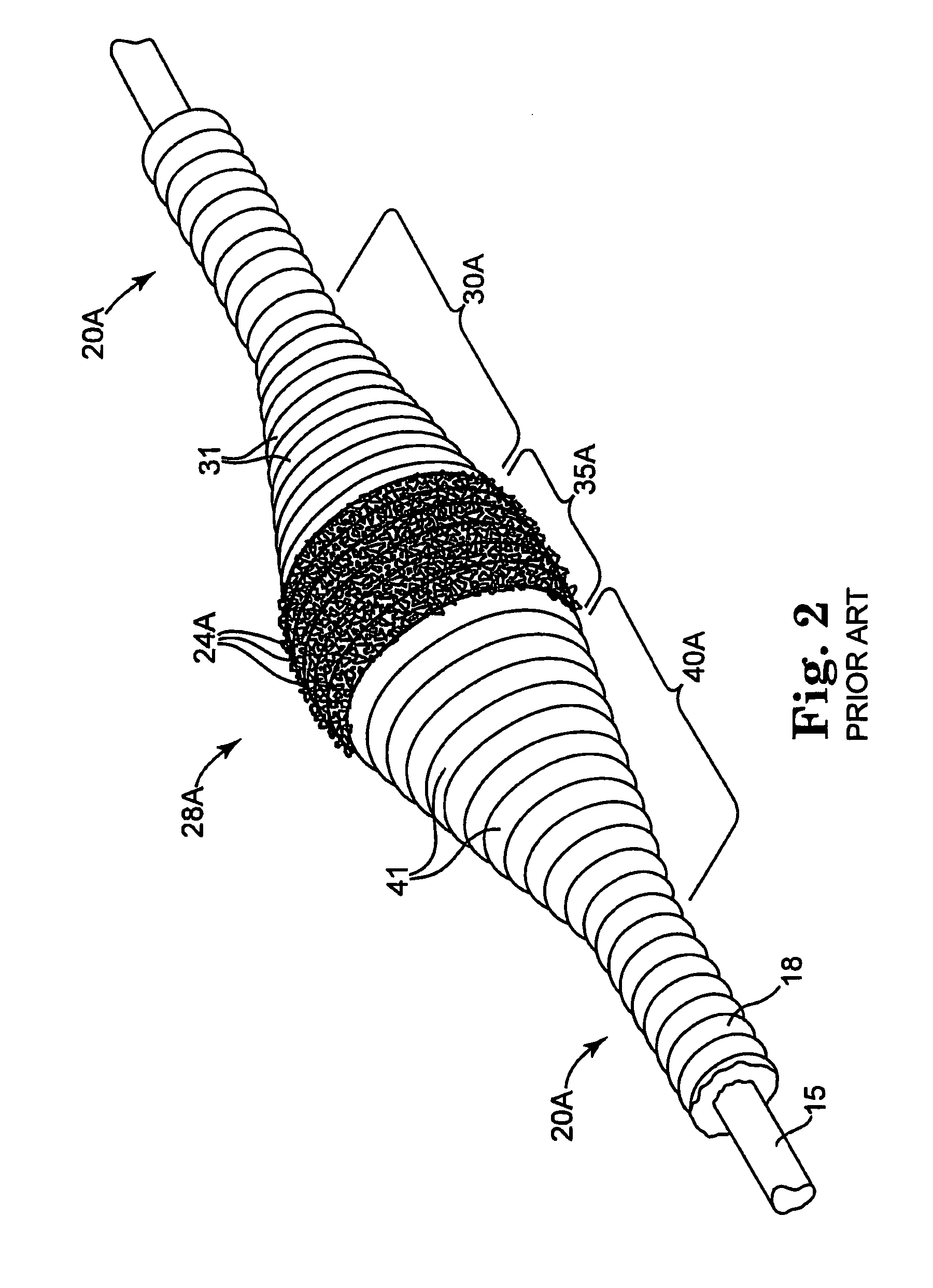 Eccentric abrading and cutting head for high-speed rotational atherectomy devices