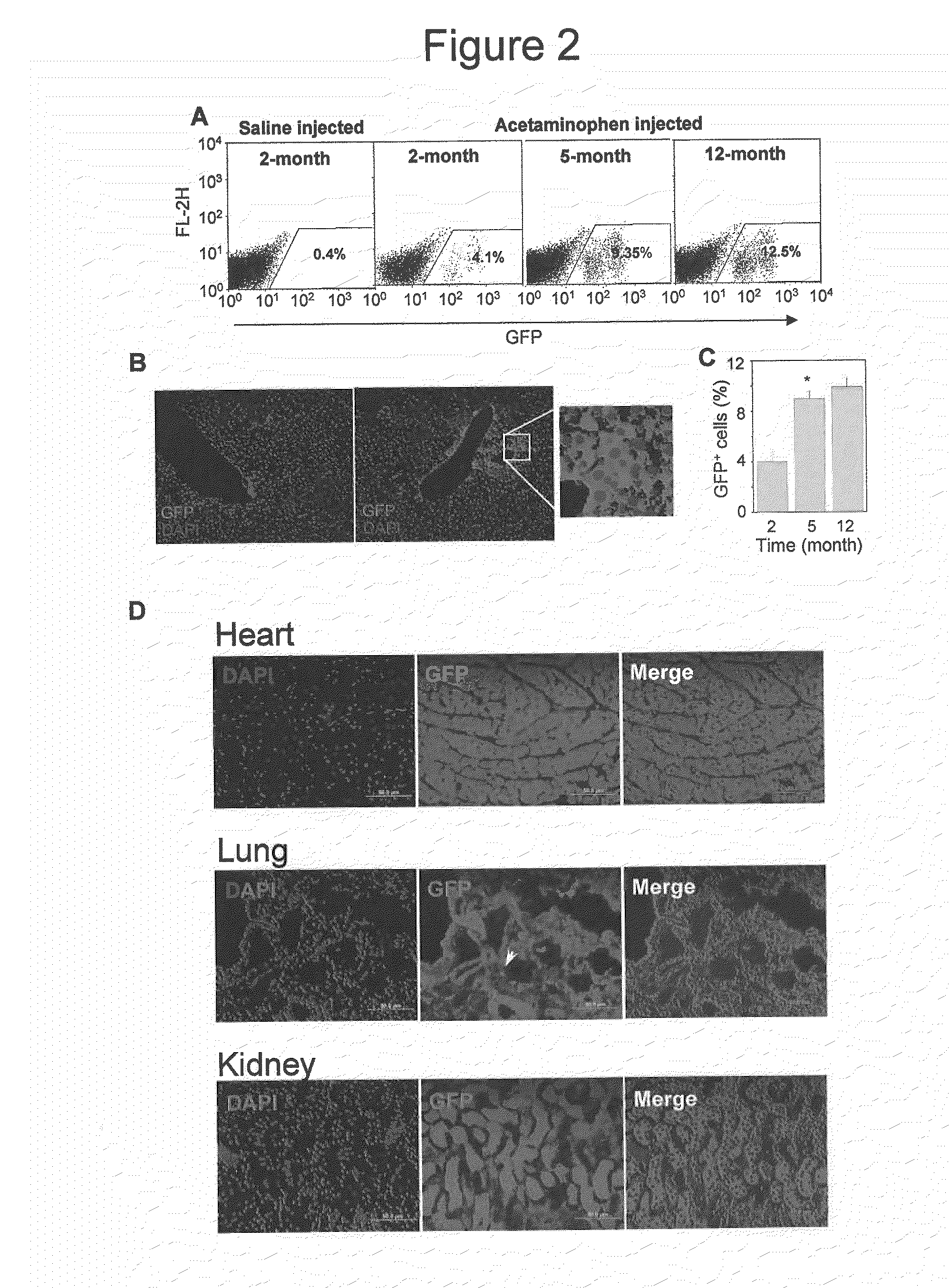 Method for the therapeutic correction of hemophilia a by transplanting bone marrow cells