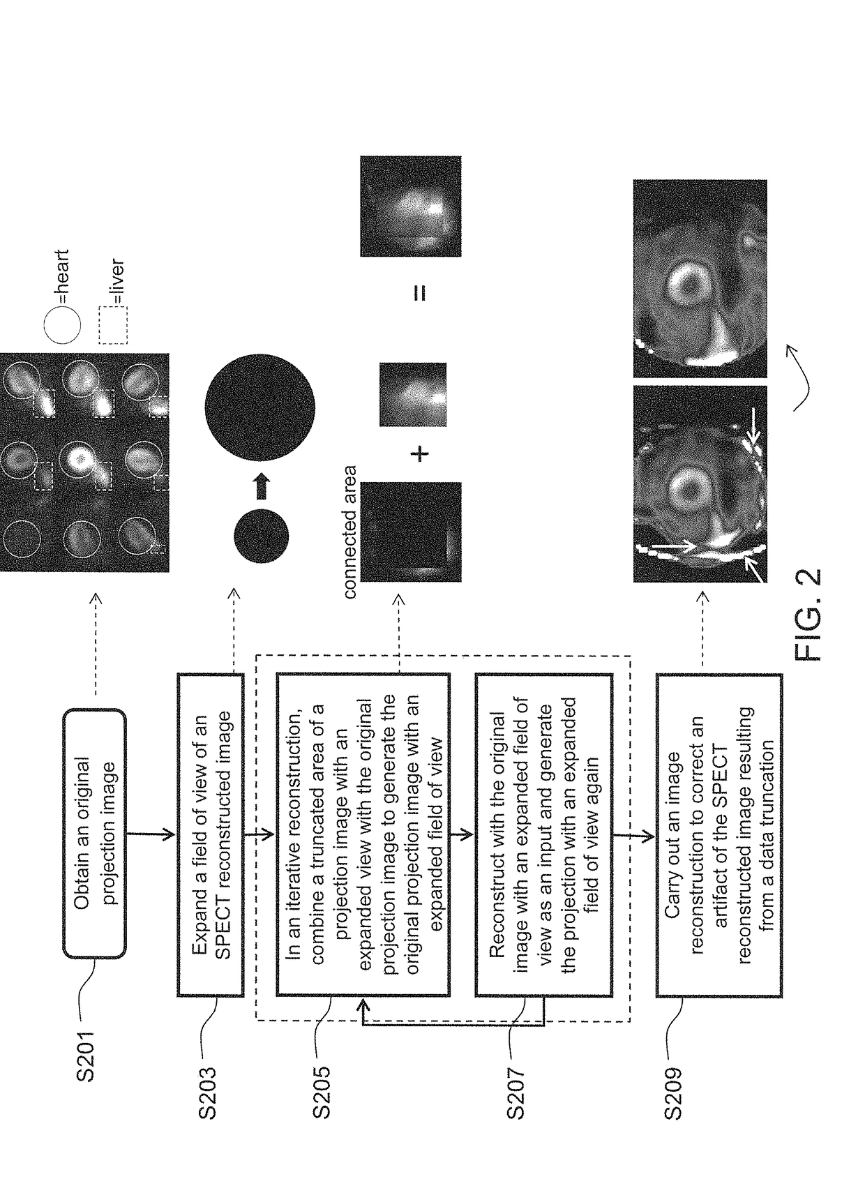 Quantitative method for nuclear medicine heart image and electronic device