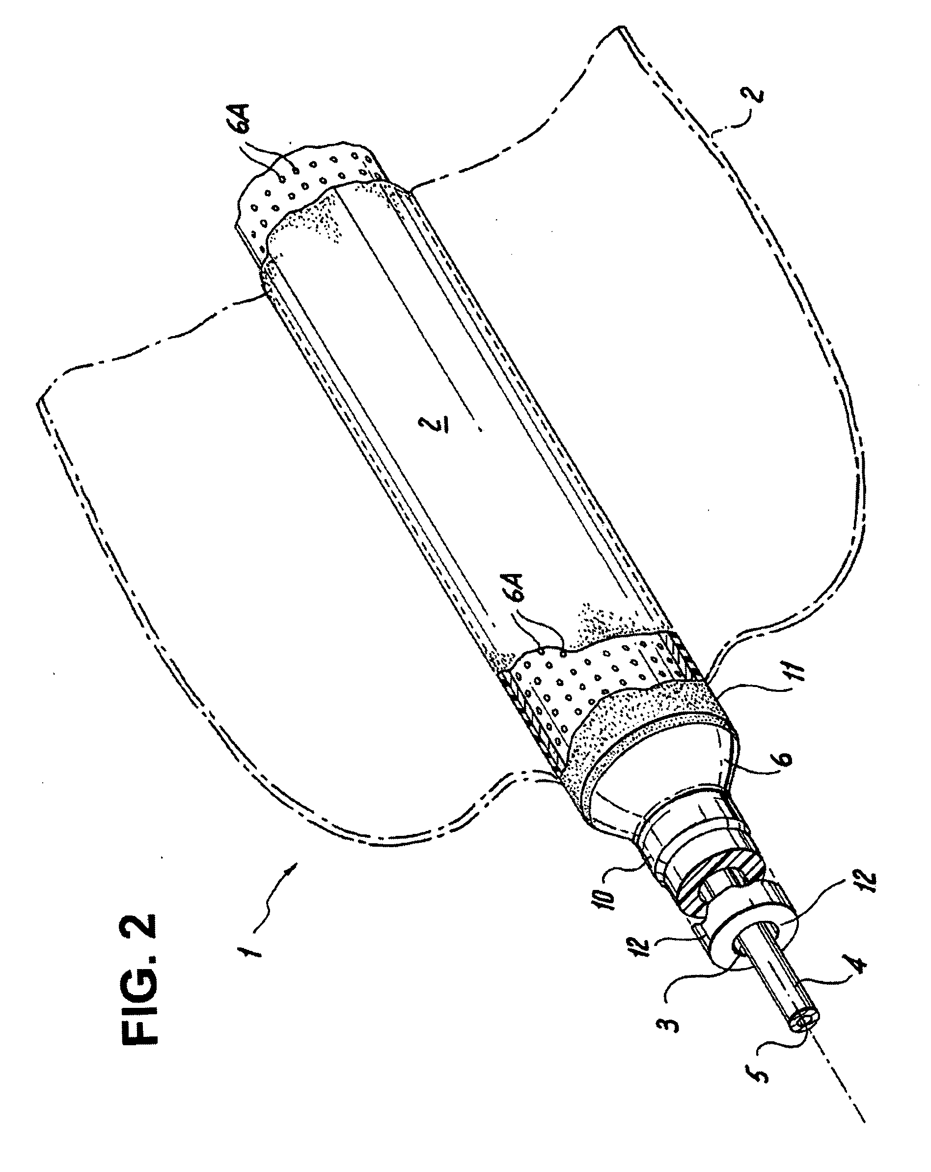 Endoscopically placed gastric balloon (EPGB) device and method for treating obesity involving the same
