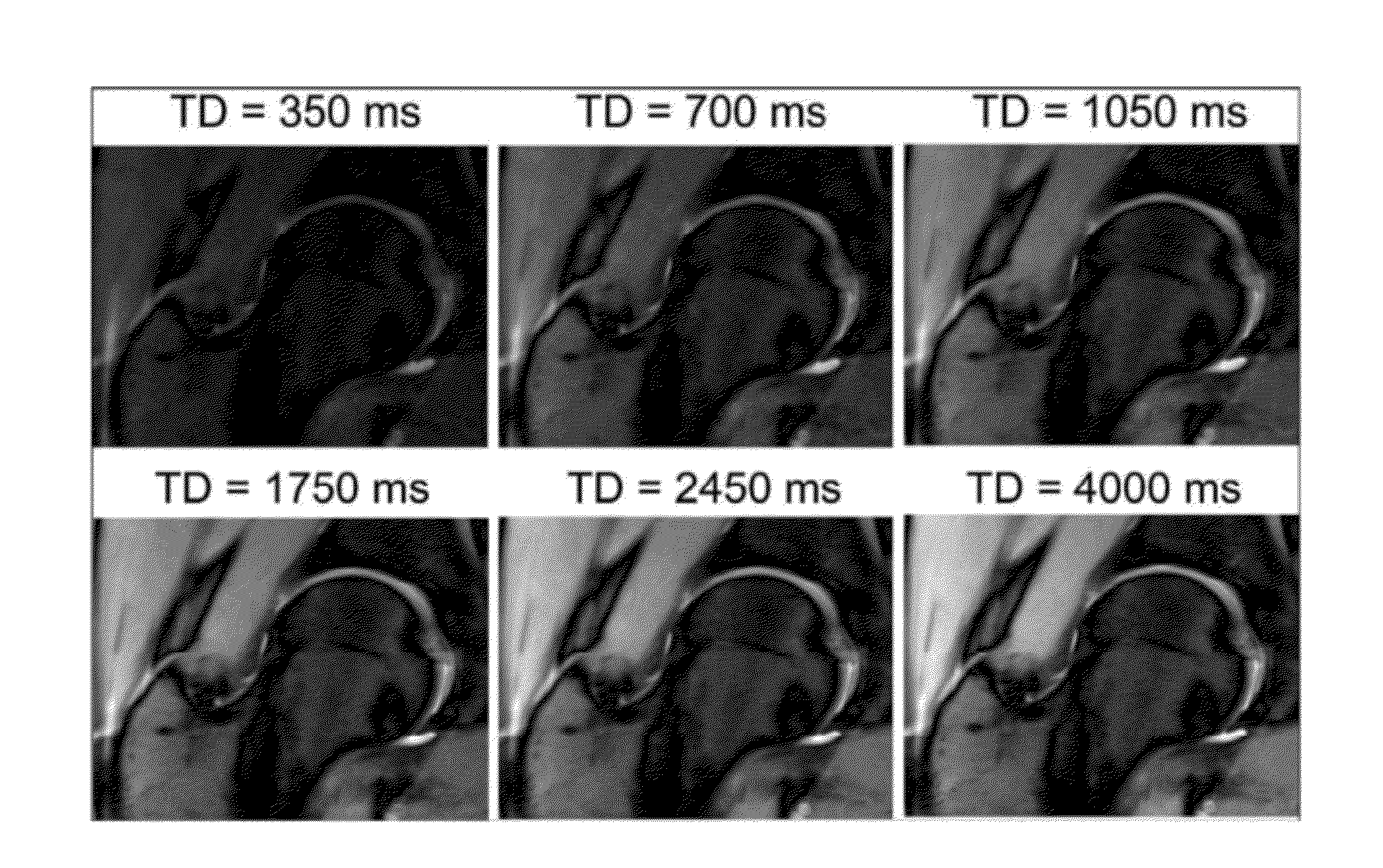 Apparatus, method, and computer-accessible medium for b1-insensitive high resolution 2d t1 mapping in magnetic resonance imaging