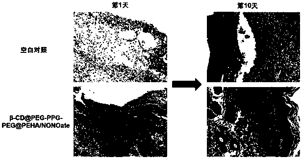 Polyrotaxane-structured NO donor material and preparation method and application thereof