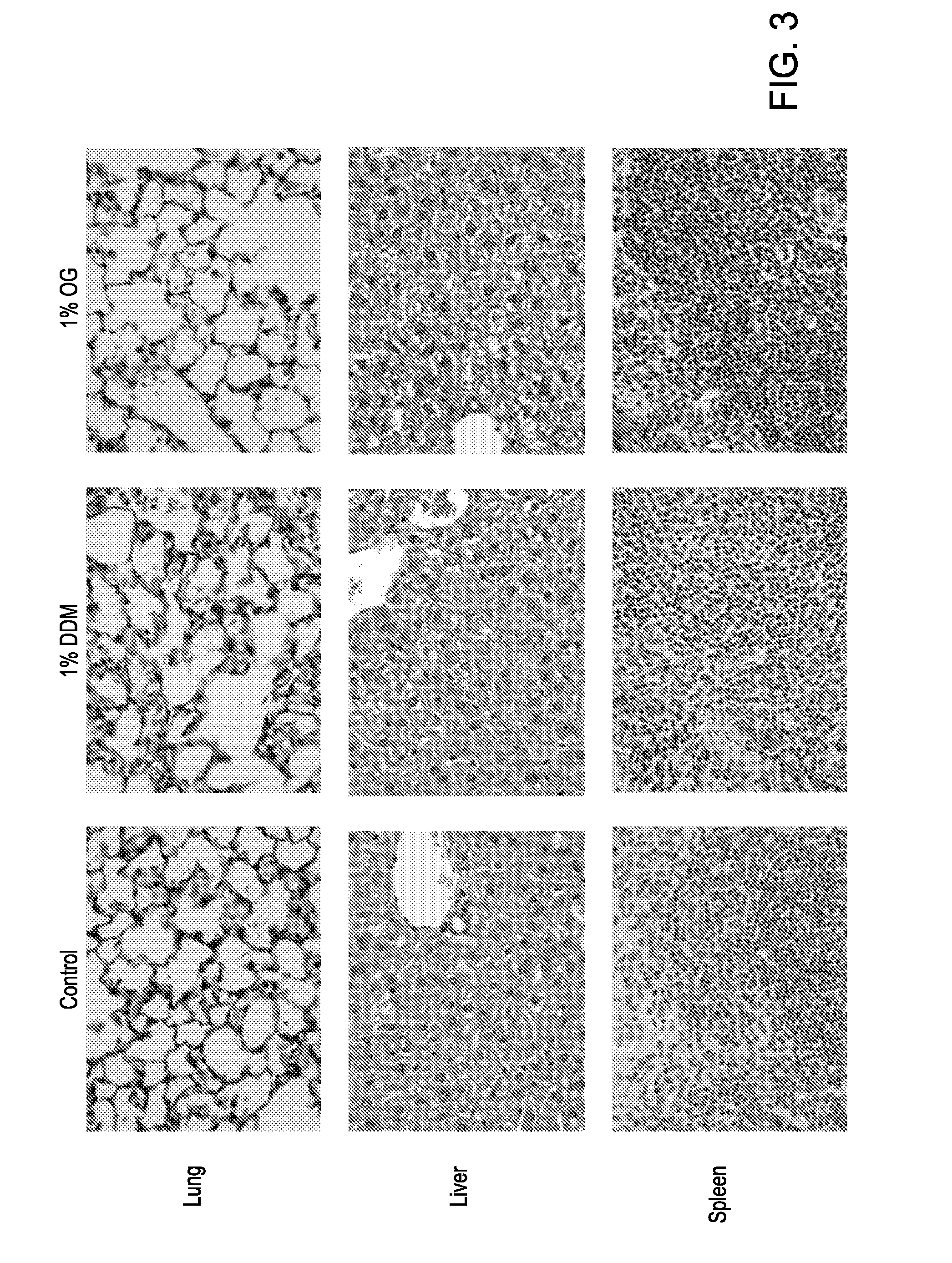 Compositions and methods for treating mycobacterial infections
