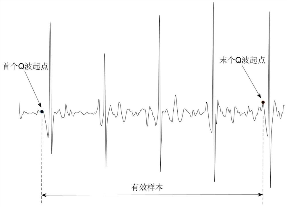 A data preprocessing method for ECG signal classification based on deep learning model