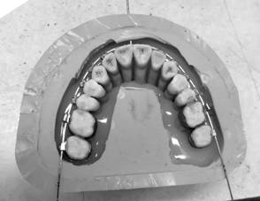 Dental model making method, dental model and orthodontic force measurement method