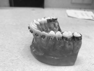 Dental model making method, dental model and orthodontic force measurement method