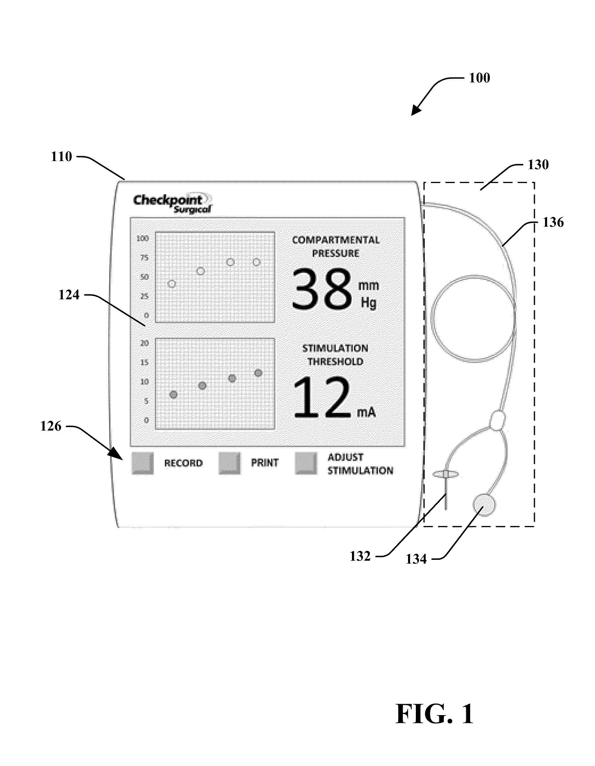 Percutaneous stimulation device and method for detecting compartment syndrome