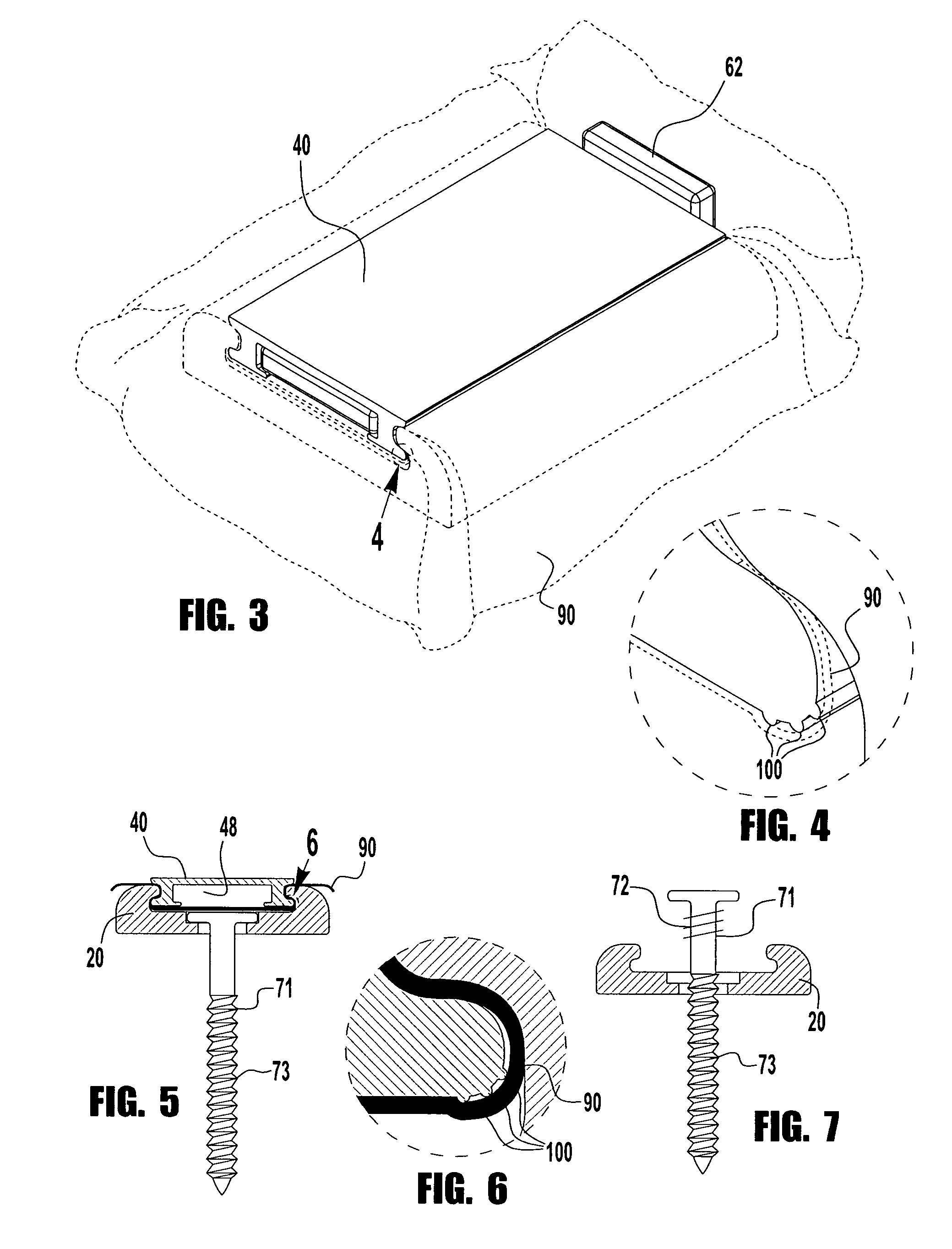 Non-penetrating elastomeric membrane anchoring system