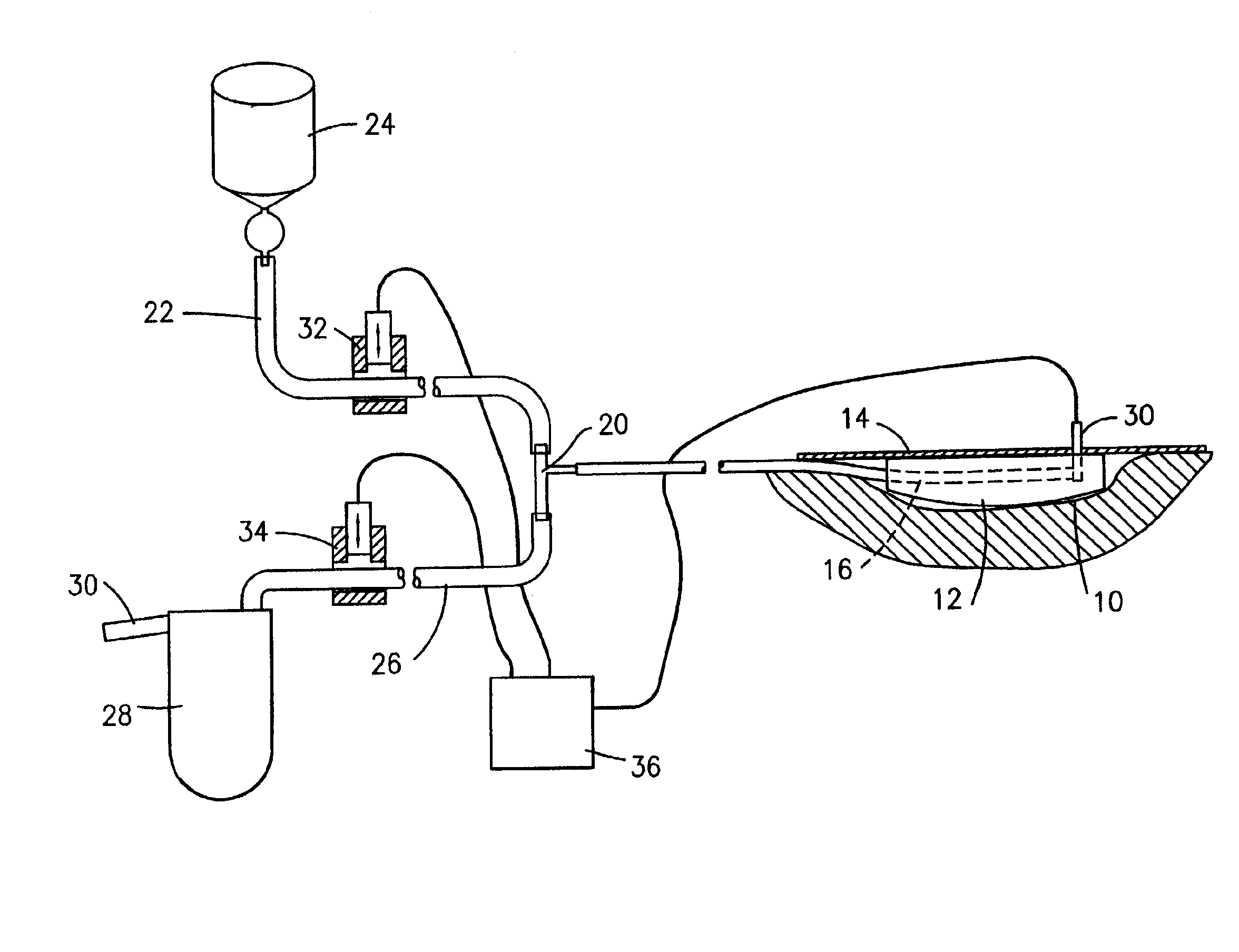 Process and device for application of active substances to a wound surface