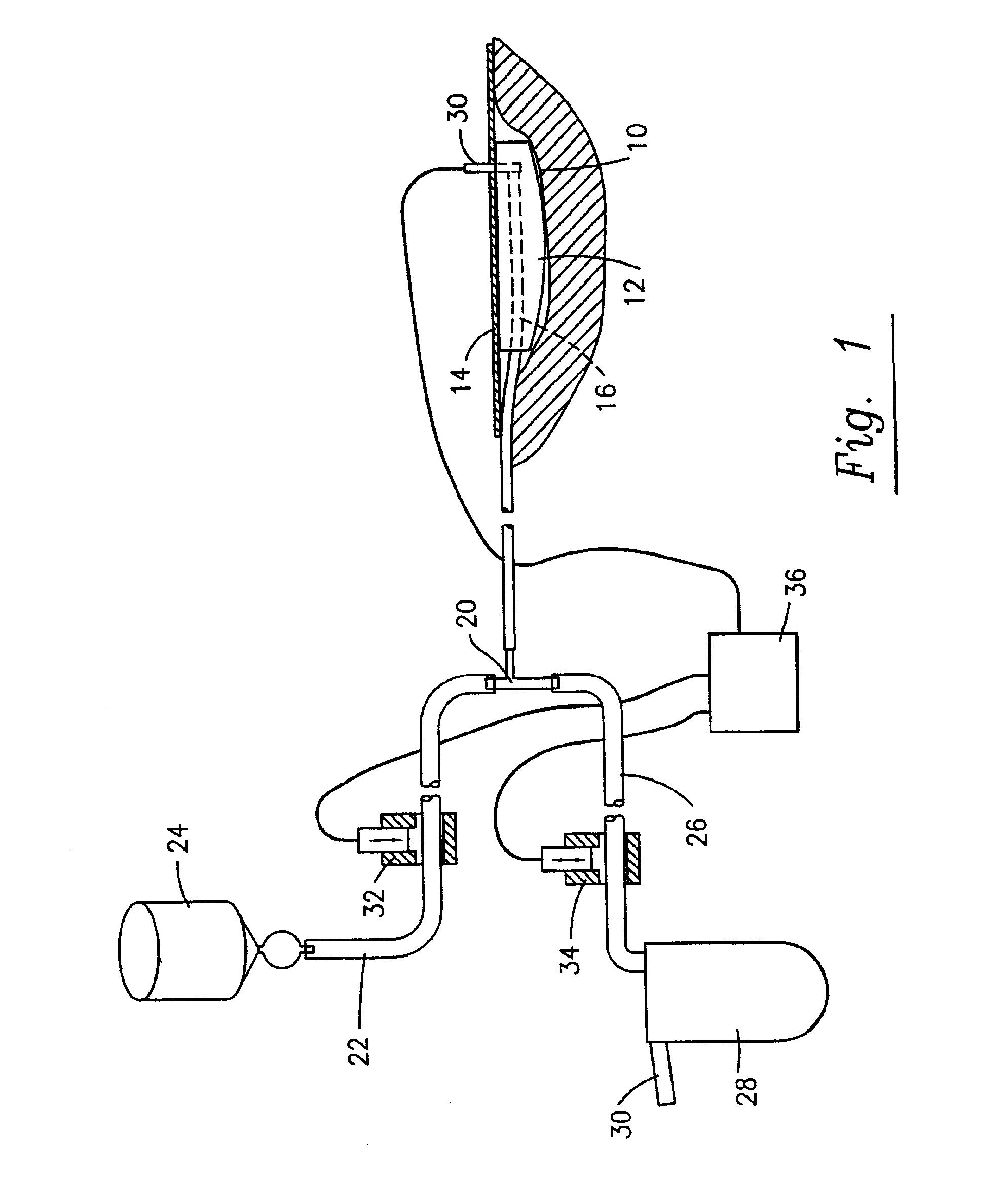 Process and device for application of active substances to a wound surface