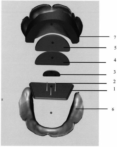 A Disposable Gothic Bow Tracer in the Mouth and a Method for Determining Median Relation Position