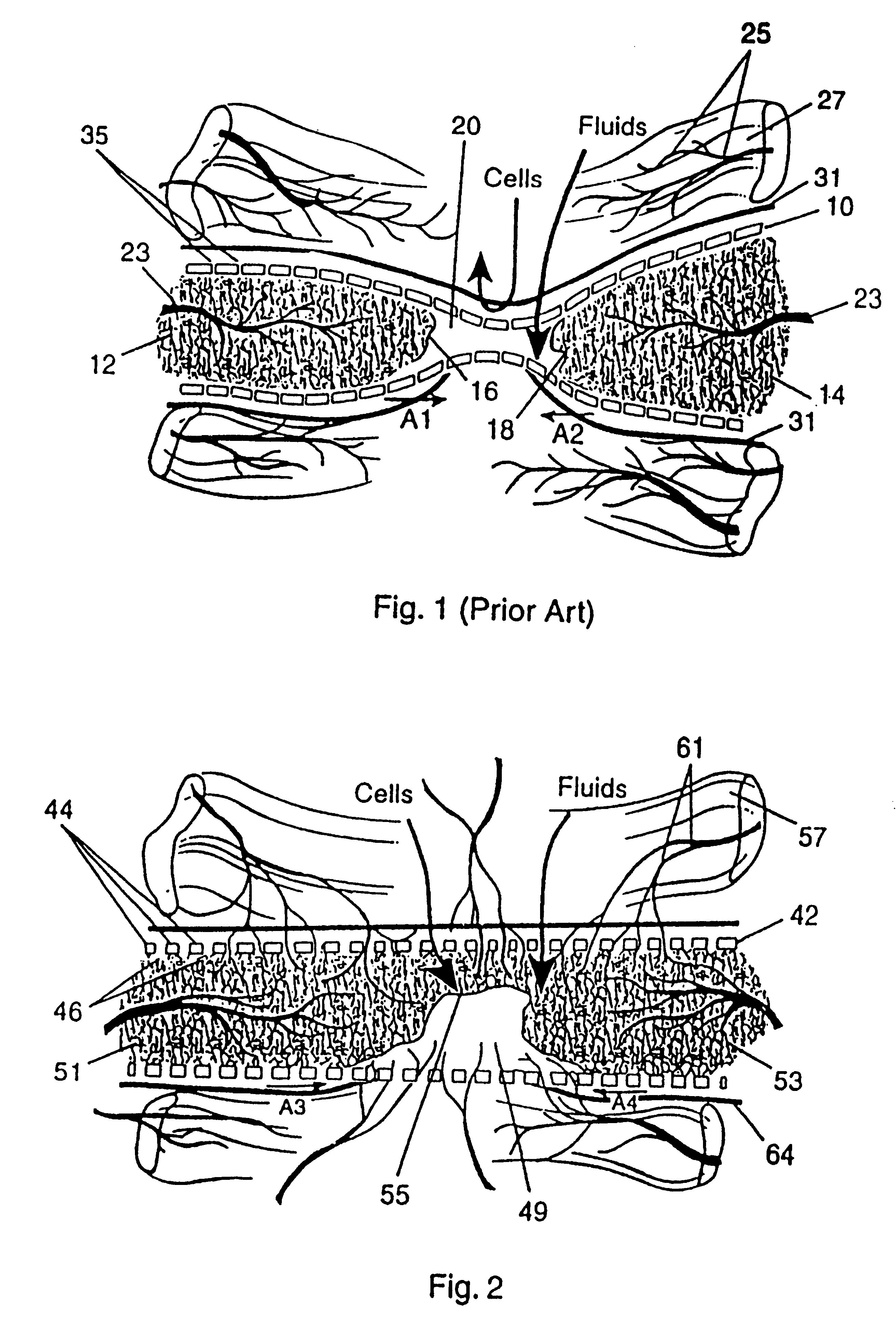 Membrane with tissue-guiding surface corrugations