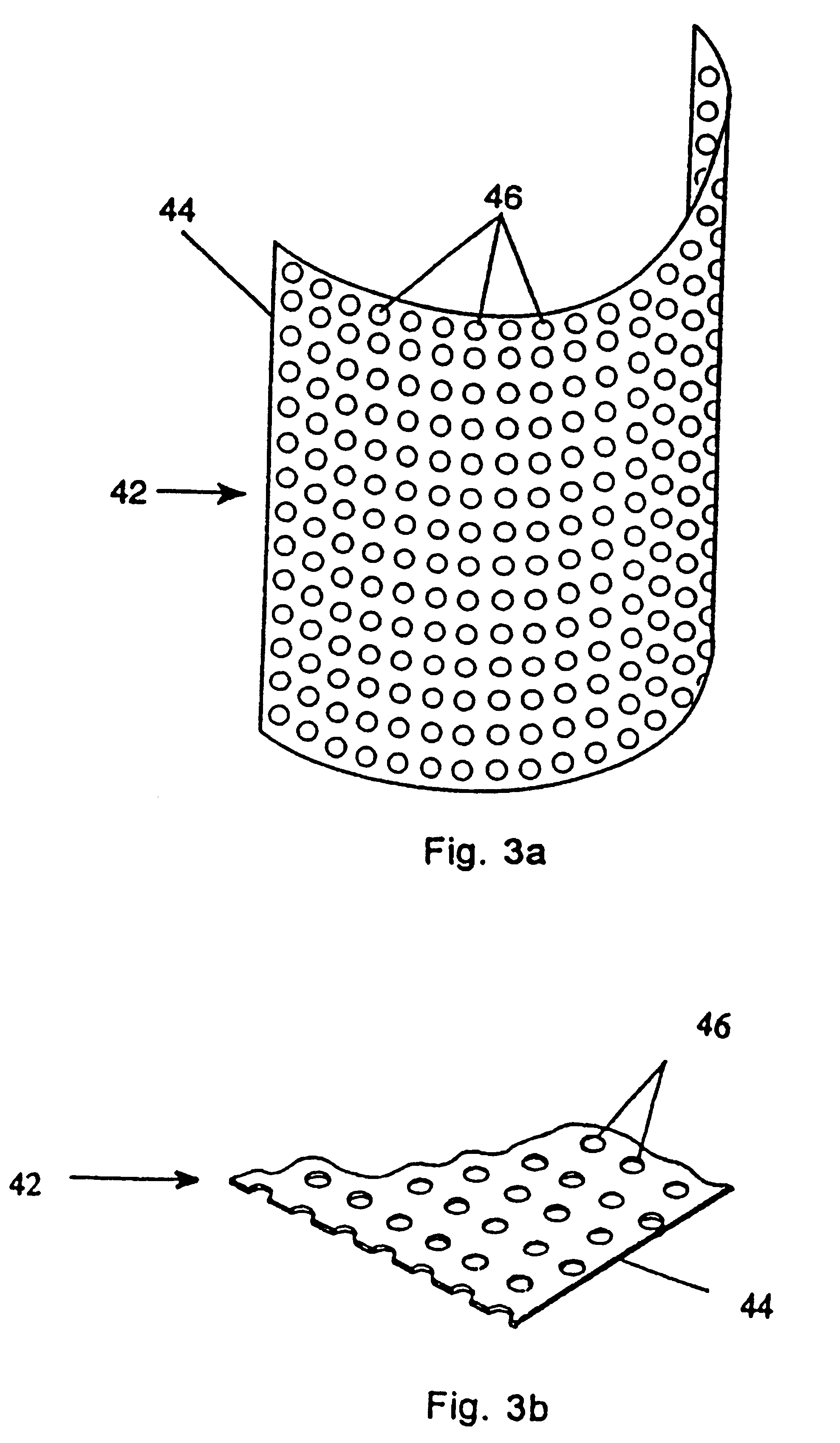 Membrane with tissue-guiding surface corrugations
