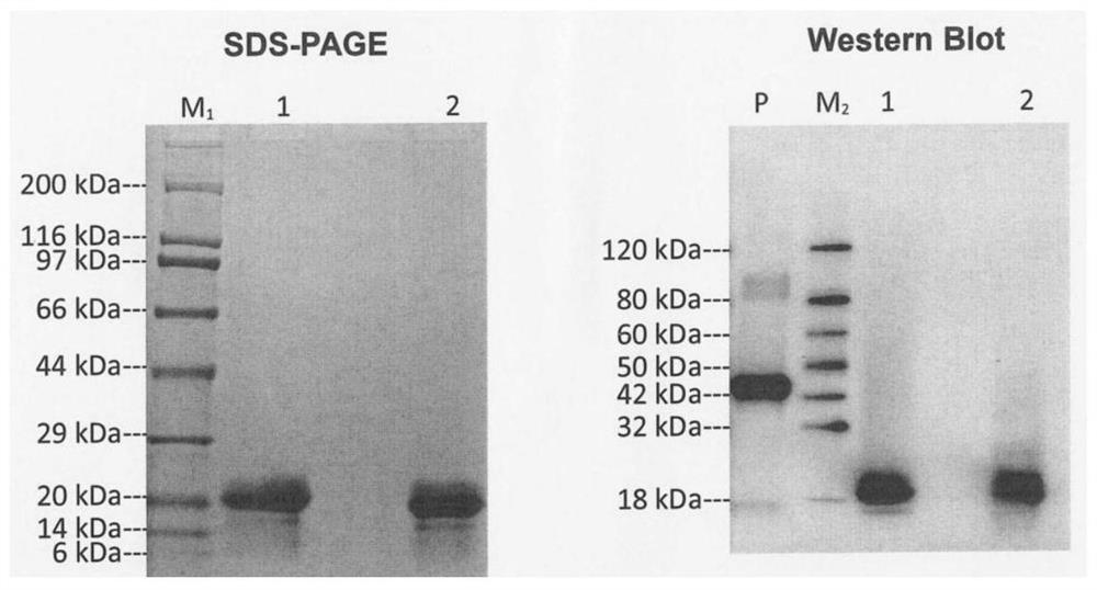 Myelin oligodendrocyte glycoprotein antibody kit and detection method thereof