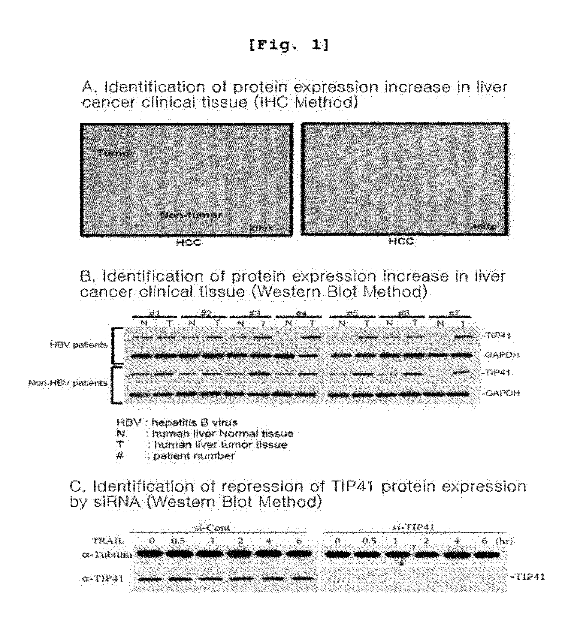 Composition for enhancing trail sensitivity comprising inhibitors for expression or activity of tip41 as a target gene of trail sensitizer