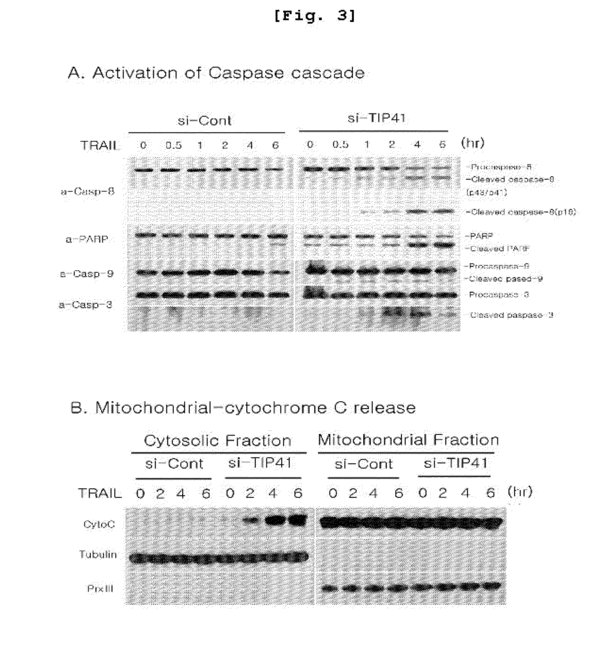 Composition for enhancing trail sensitivity comprising inhibitors for expression or activity of tip41 as a target gene of trail sensitizer