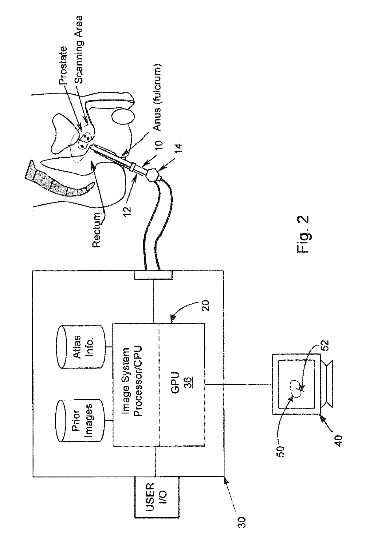Apparatus for real-time 3D biopsy