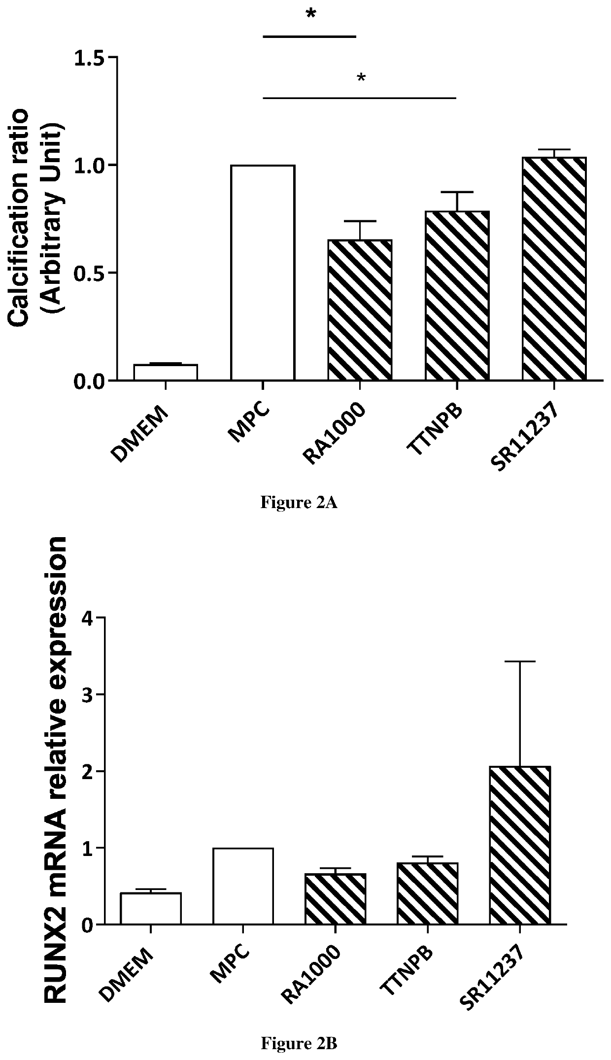 Use of retinoic acid receptor (RAR) agonists for reversing, preventing, or delaying calcification of aortic valve
