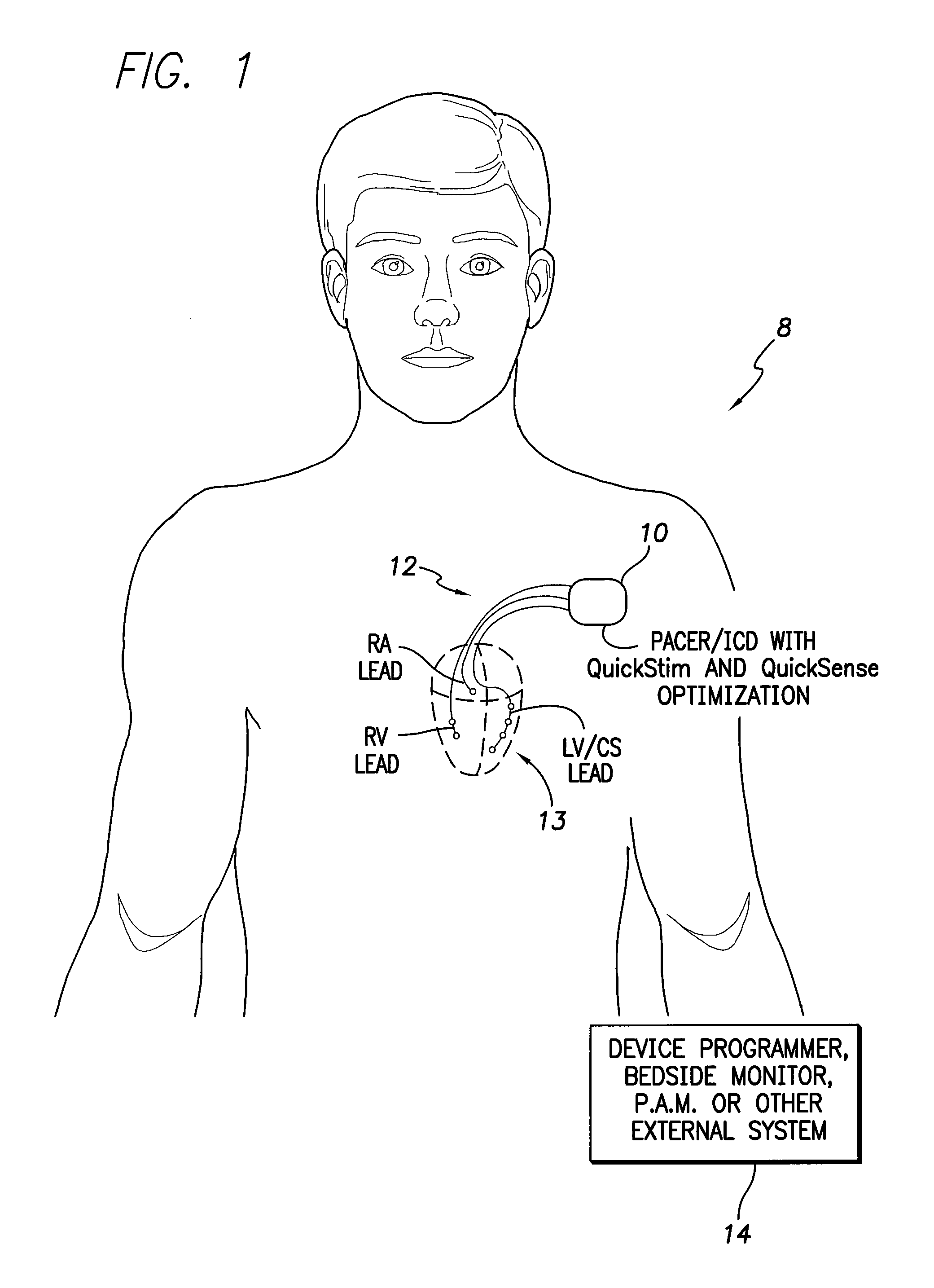 Systems and methods for optimizing multi-site cardiac pacing and sensing configurations for use with an implantable medical device