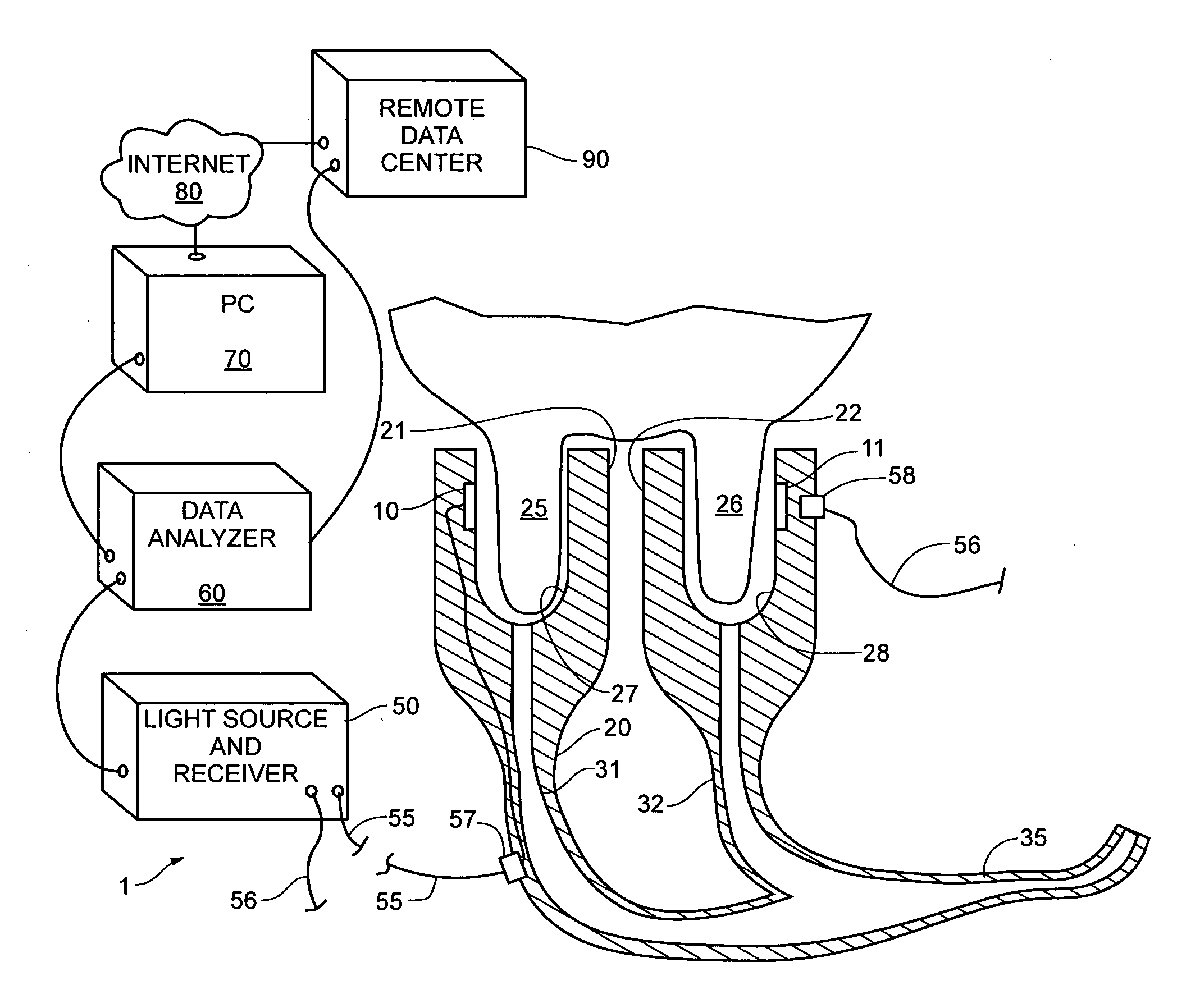 Device, system and method of non-invasive diagnosis of mastitis in a dairy cow
