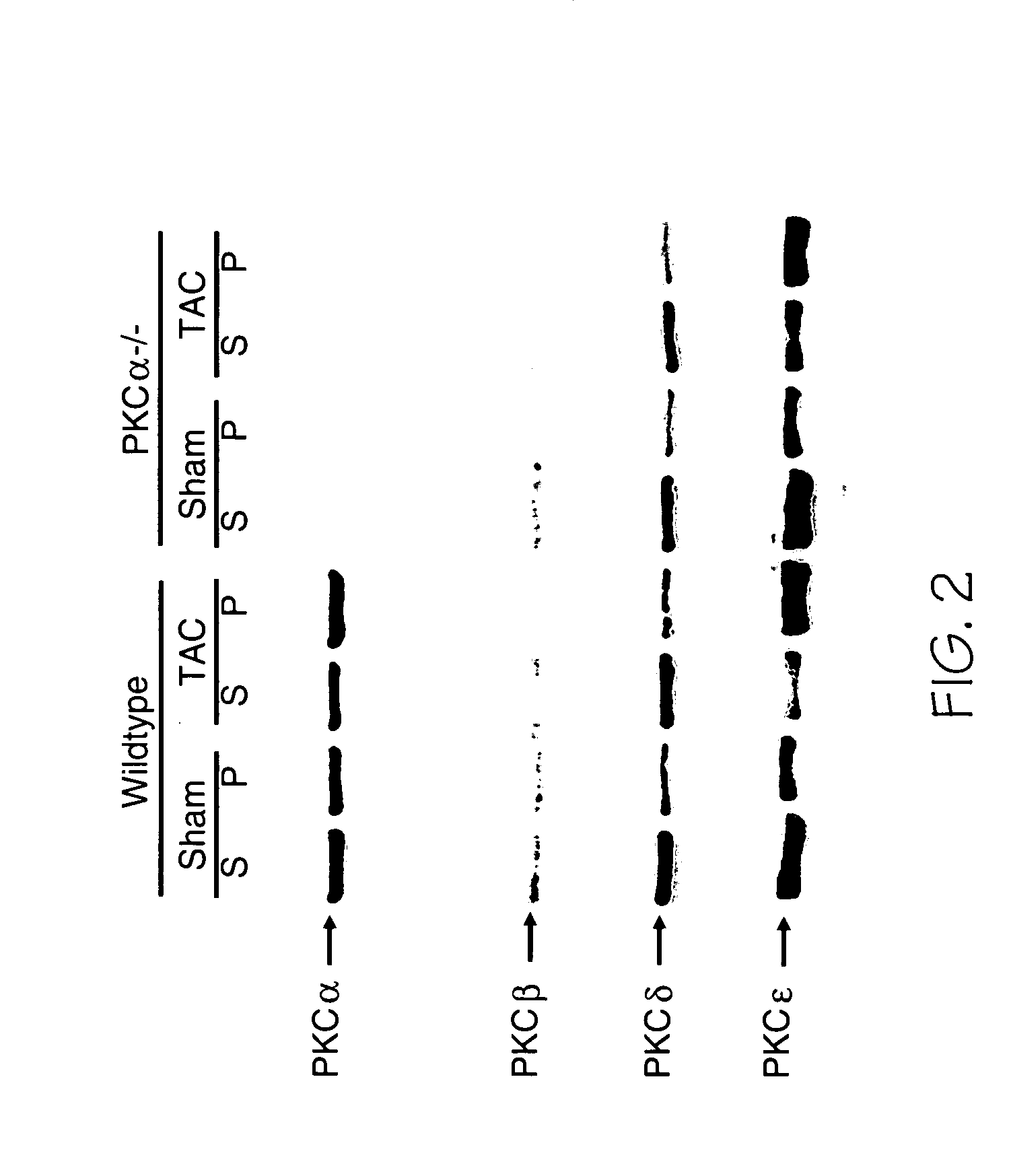 Regulation of cardiac contractility and heart failure propensity