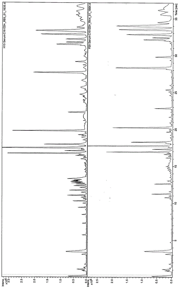 Method for determining and screening differential metabolites of laryngeal cancer serum based on inverted phase chromatography time-of-flying mass spectrum