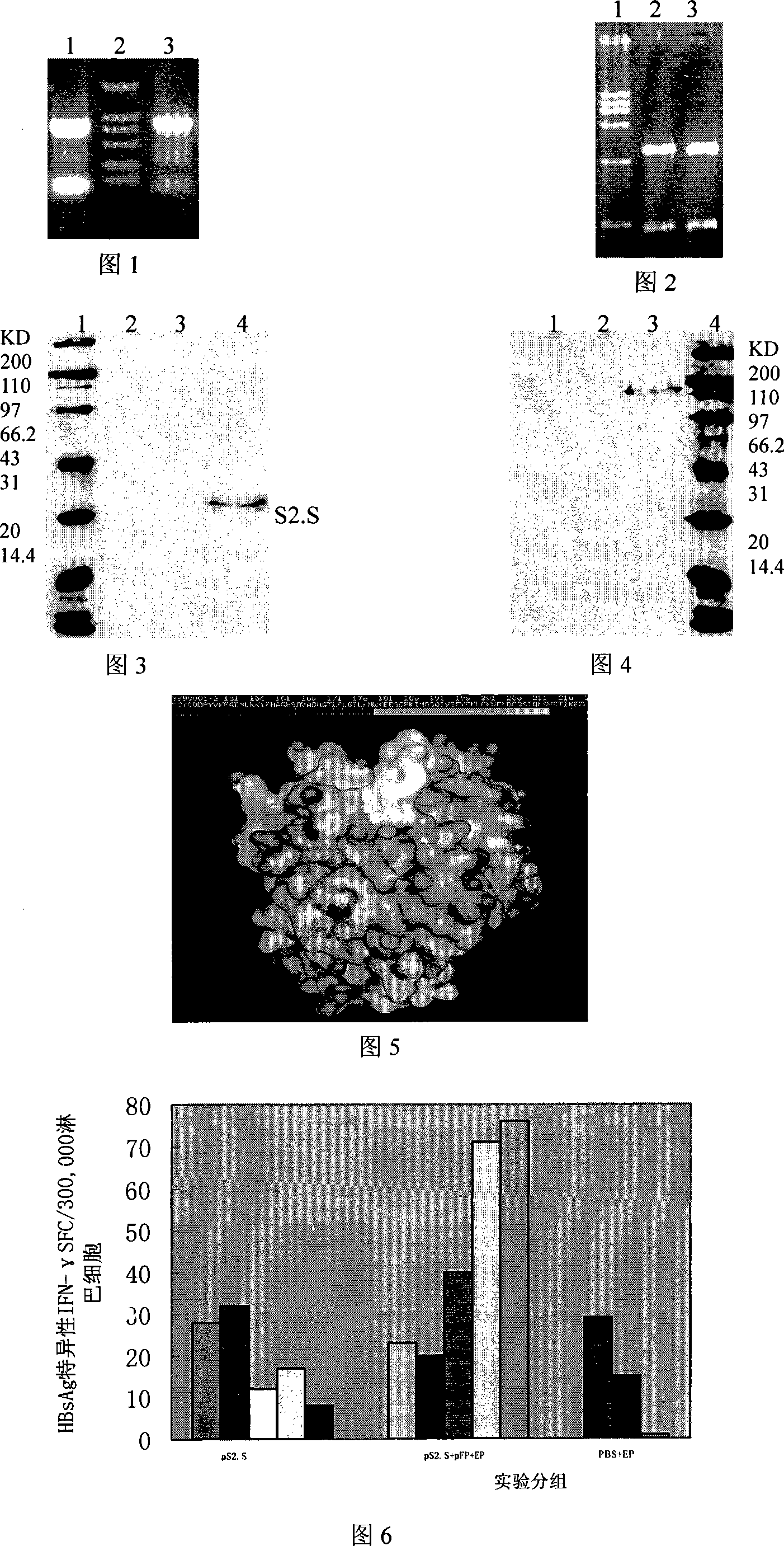 Therapeutic HBV DNA vaccines, method for preparing the same and application thereof