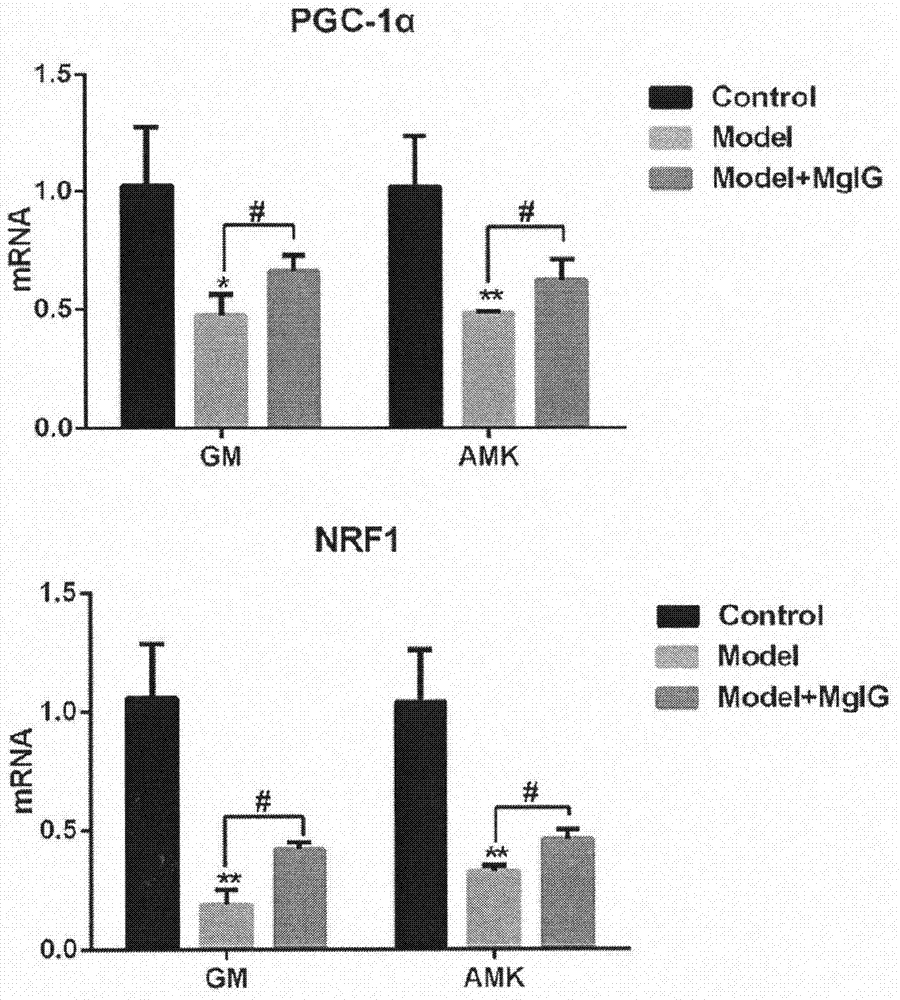 Application of MgIG (magnesium isoglycyrrhizinate) in preparing treatment drug for relieving renal injury caused by aminoglycoside antibiotics