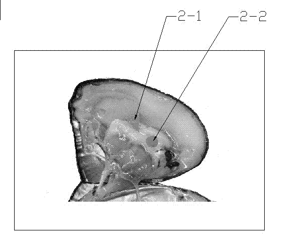 Method of embedding nuclei inside hyriopsis schlegeli for breeding oversized round-shaped pearls