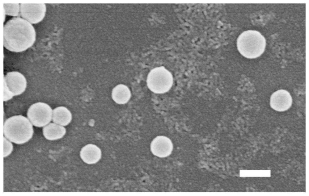 Tumor microenvironment response type nanoparticle based on biomimetic engineering as well as preparation method and application thereof