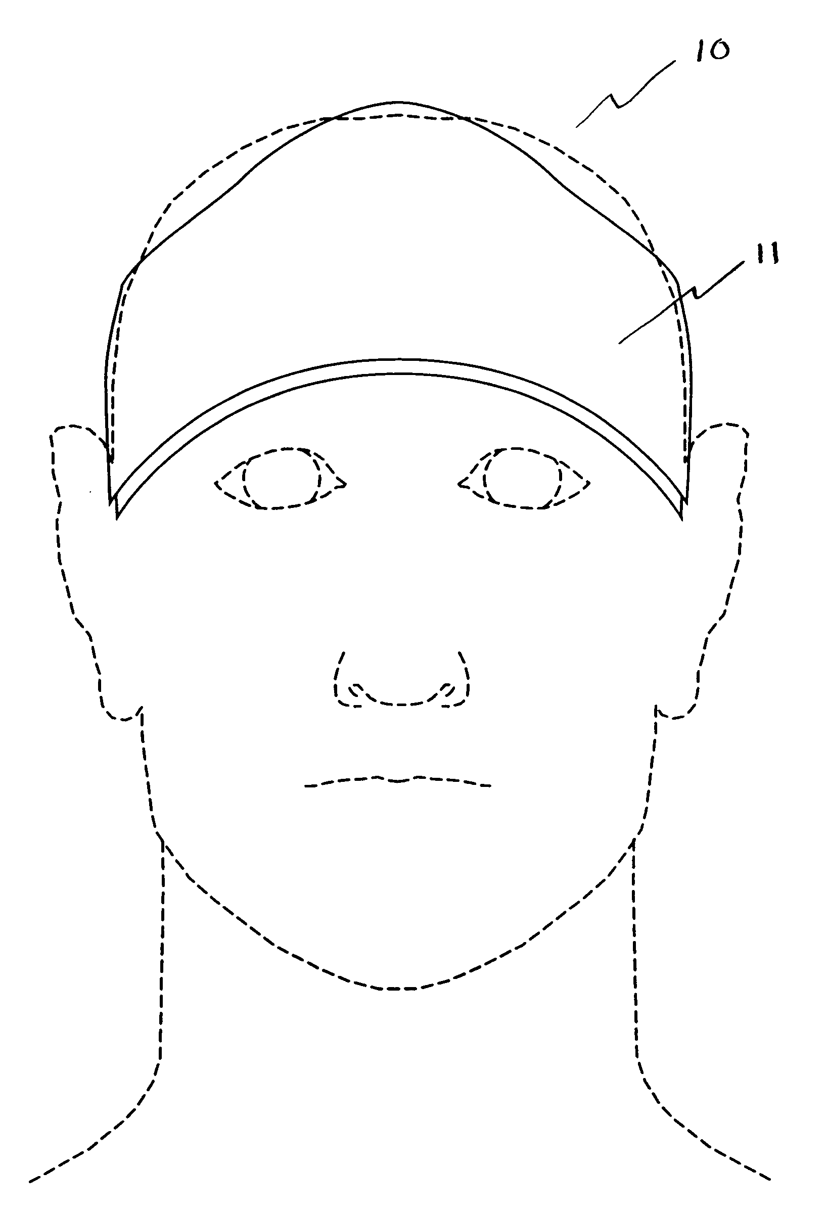 Method and apparatus of noninvasive, regional brain thermal stimuli for the treatment of neurological disorders