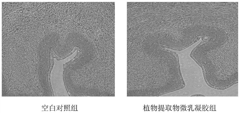 A kind of microemulsion gel of anti-HPV plant extract and preparation method and application thereof