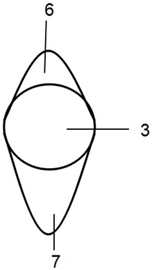 Branch type sawtooth-shaped thrombus breaking balloon catheter