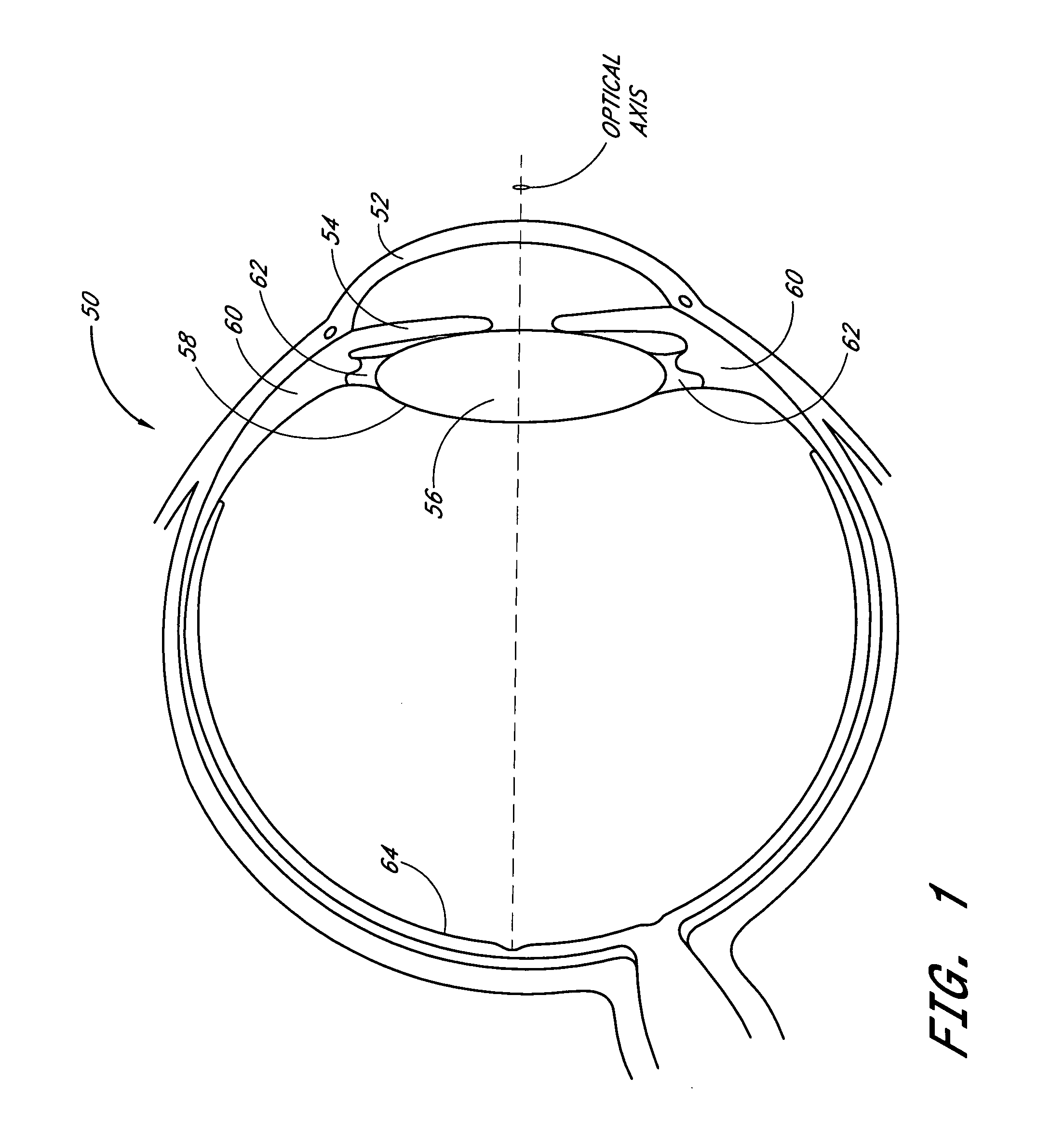 Accommodating intraocular lens system with separation member