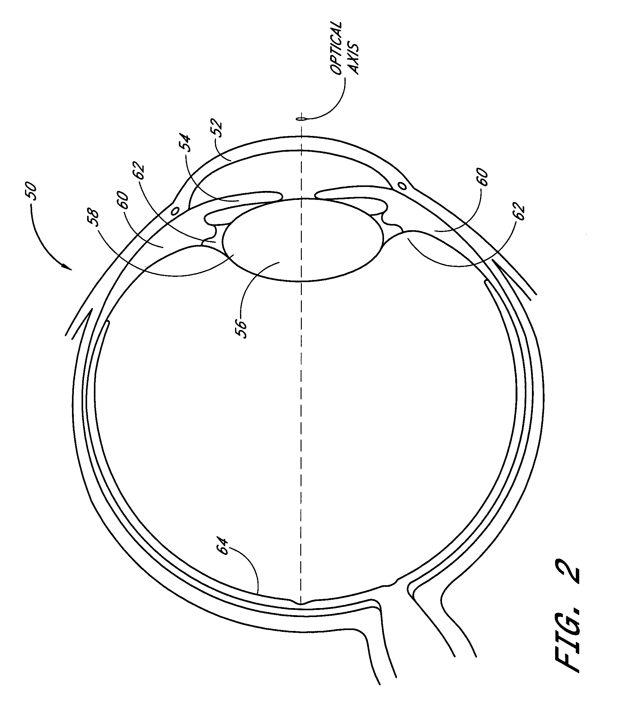 Accommodating intraocular lens system with separation member