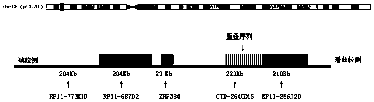 Leukemia ZNF384 gene fragmentation probe disruption kit