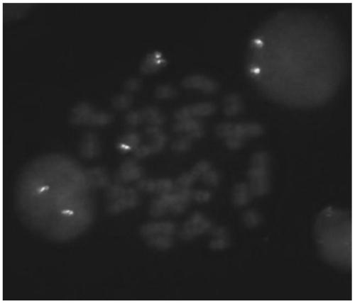 Leukemia ZNF384 gene fragmentation probe disruption kit