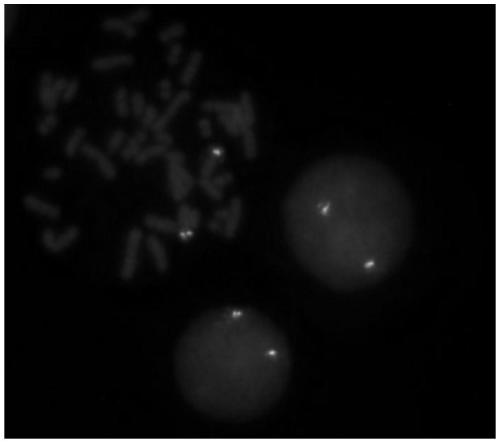 Leukemia ZNF384 gene fragmentation probe disruption kit