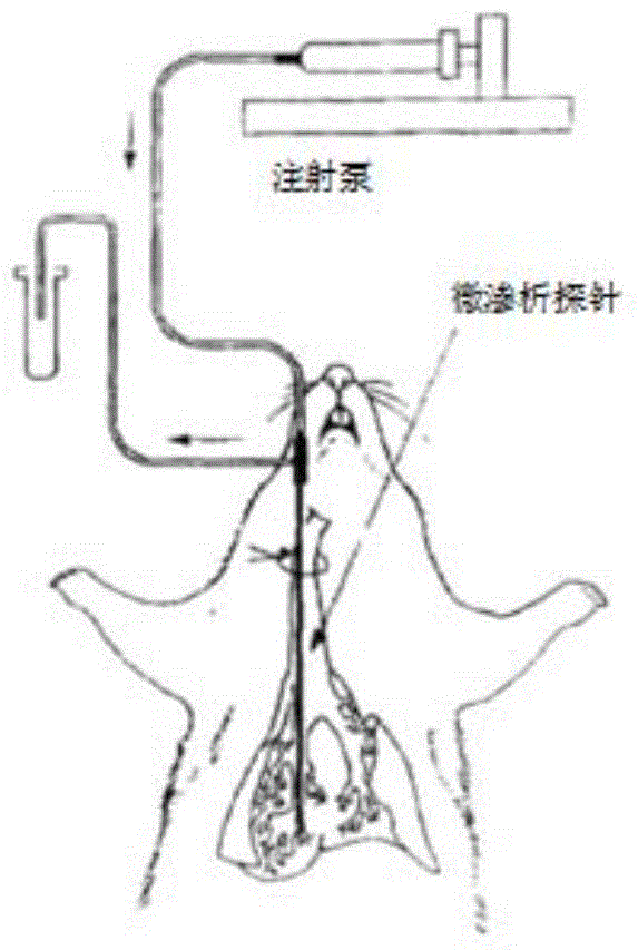 Pidotimod inhalation powder aerosol and preparation method thereof