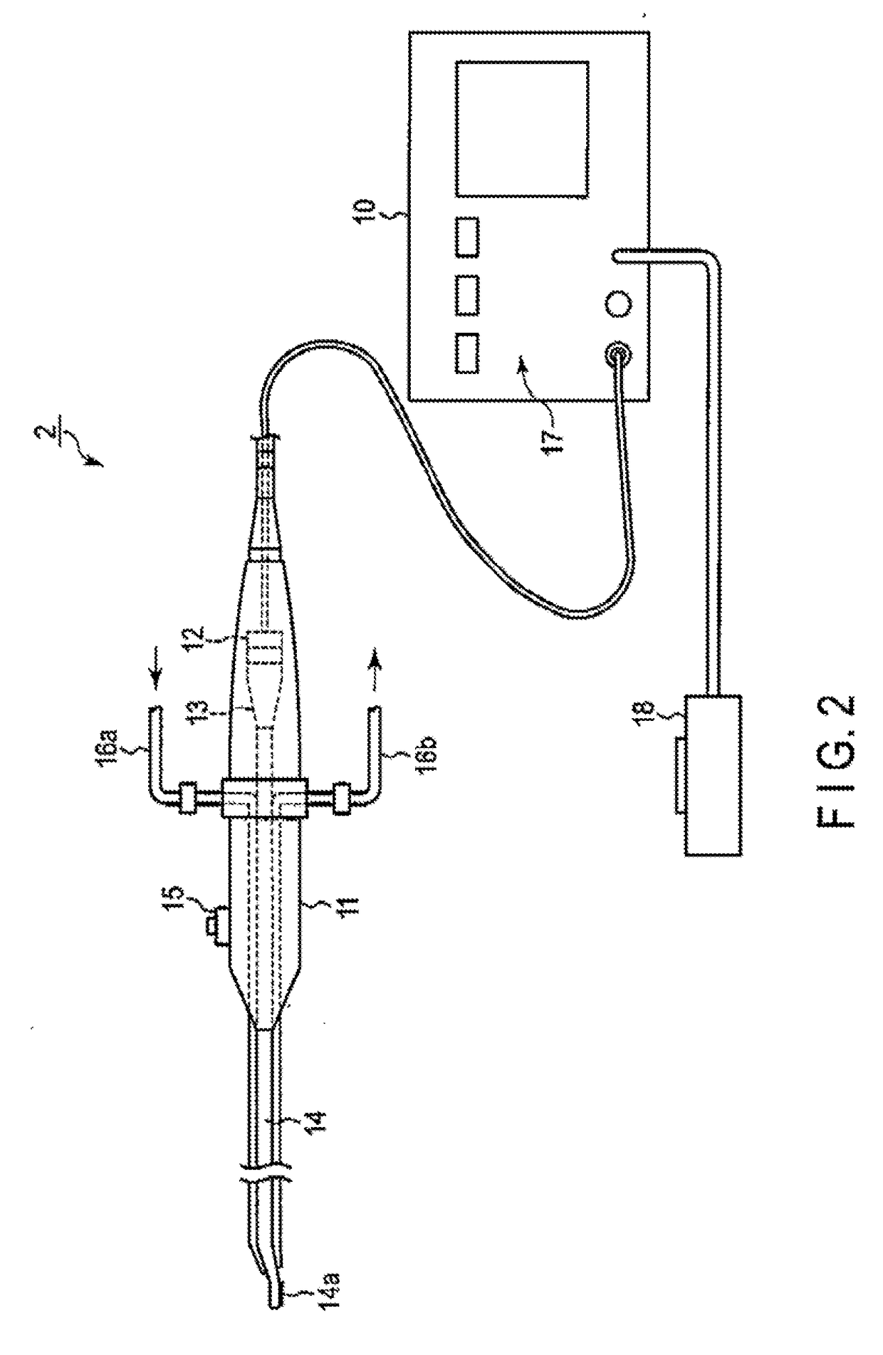 Method for replacement althroplasty