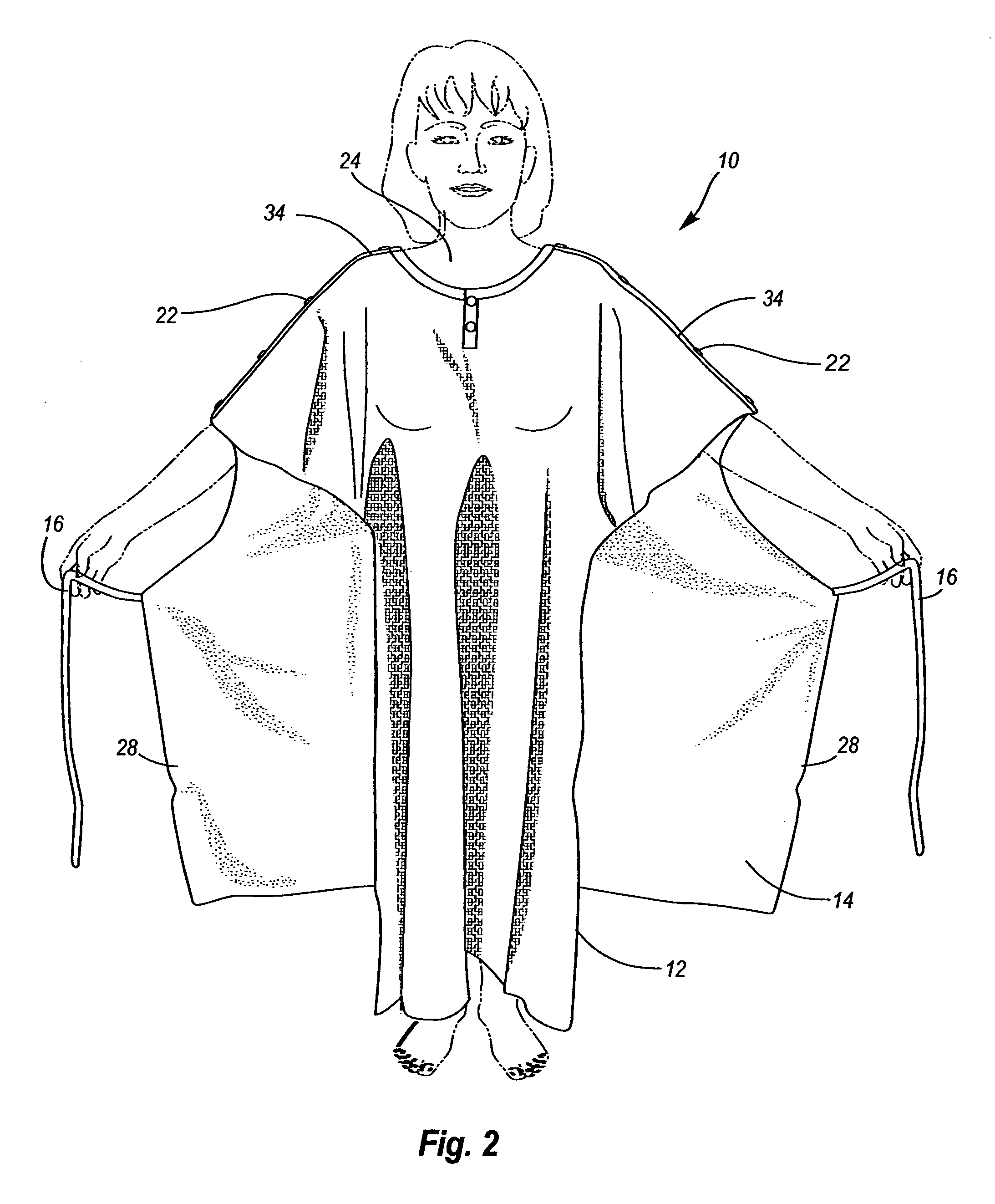 Hospital gown with enhanced privacy features