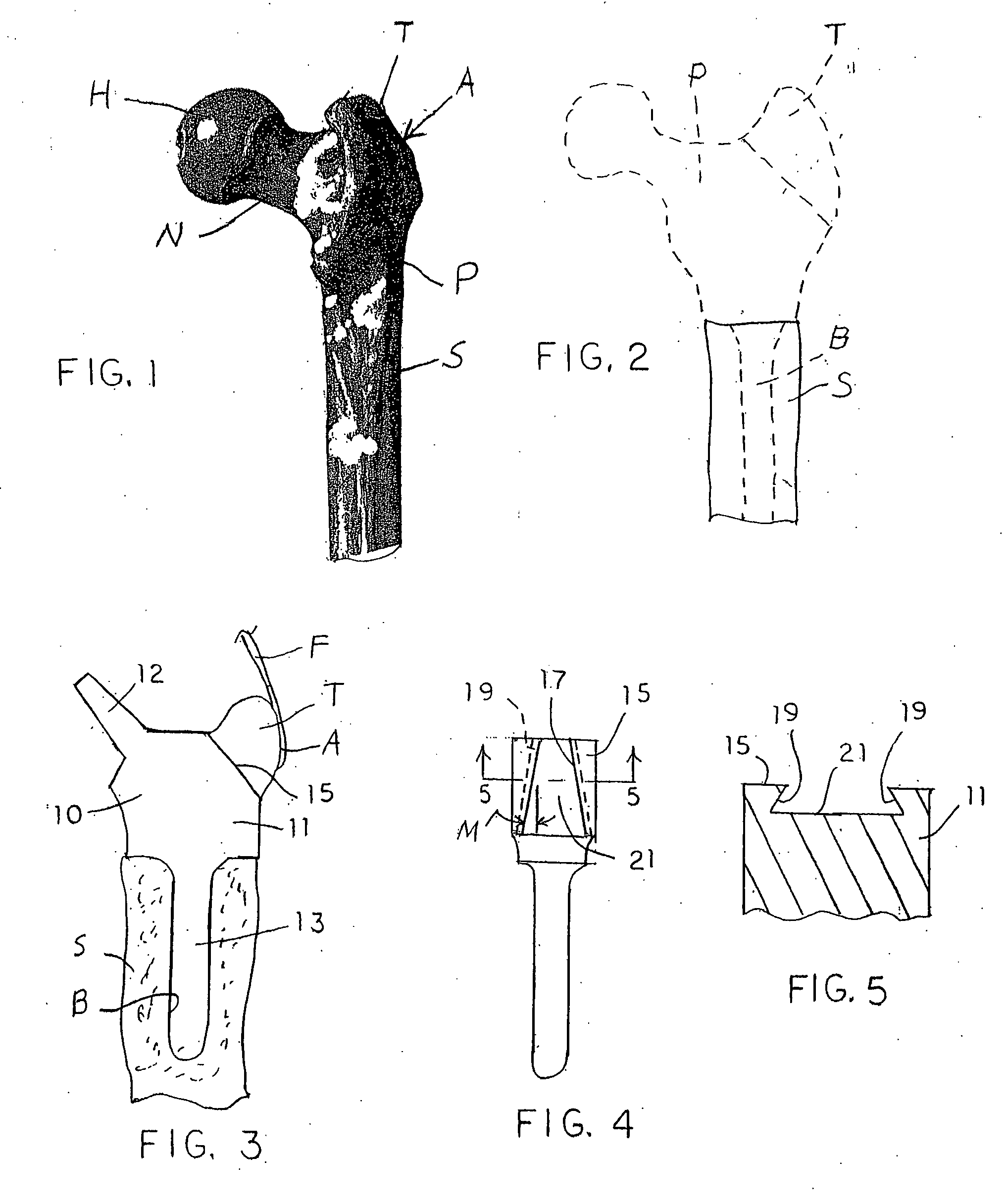 Soft tissue attachment system and method