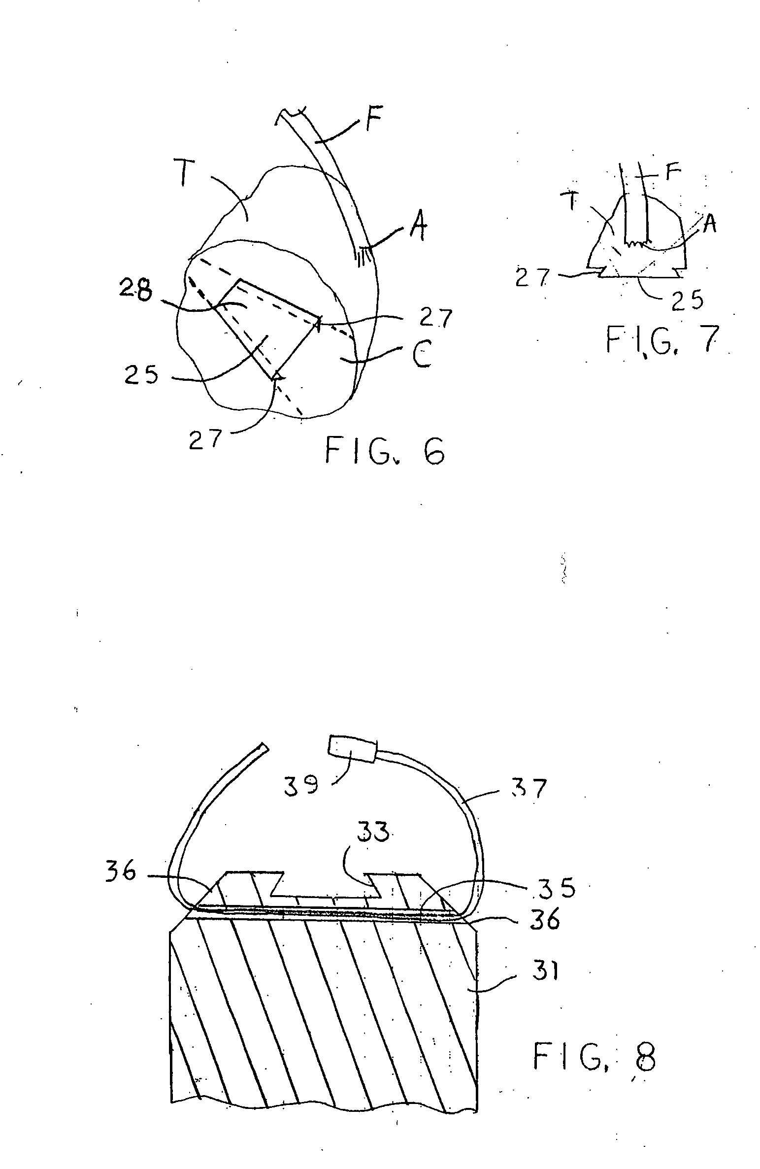 Soft tissue attachment system and method